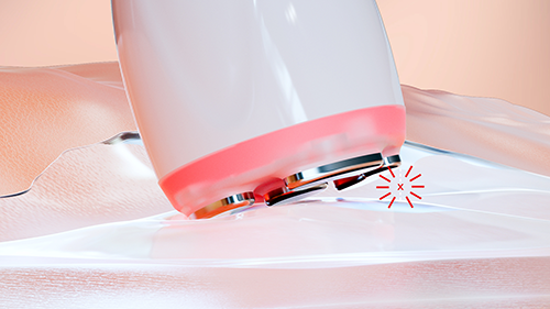 Sensor de contacto en handpiece de Radiofrecuencia Facial Apollo Duet